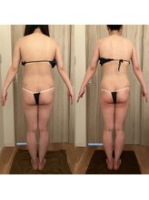 レジュベール(Rejuvel)/ヒップUP↑