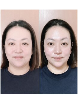 ビューティフルムーン(Beautiful Moon)/小顔デザイン&小顔矯正&全身矯正