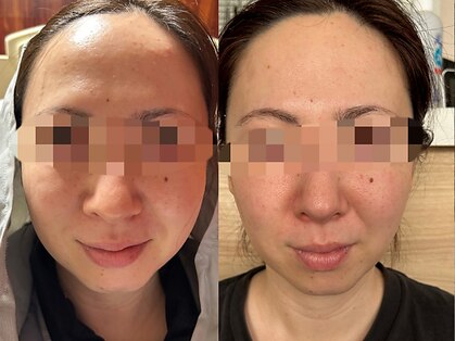 ヨサパーク ソアレ(YOSA PARK Soare)の写真