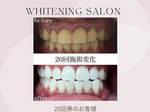 ホワイト つくば店(WHITE)/