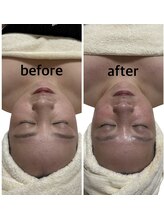 アンドエム(&M)/