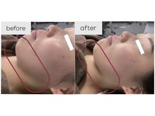 エン(O'en)/レッドショット