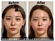 ショウフェイスデザイン(Sho Face Design)の写真
