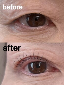 アム(amu.)/パリジェンヌラッシュリフト