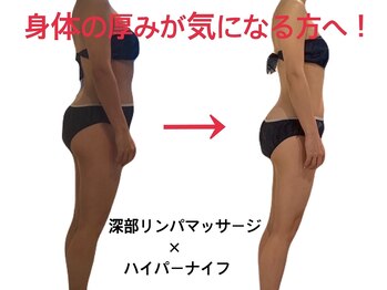 オールハンド専門店 ヒルズビューティー/身体の厚みが気になる方