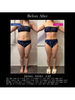 エラ(Ella)の写真/【背中ハミ肉撃退】美クビレを目指す方必見!上半身を丁寧に温め×ほぐし脂肪を徹底燃焼￥12500→￥9800