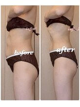 アンフィニ(infini)/短期集中全身10回コース　3ヶ月