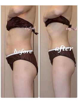 アンフィニ(infini)/短期集中全身10回コース 3ヶ月