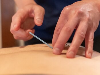 リゾート(Resort)/【腰痛＊鍼灸】