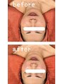 エステティックサロン ル ソイル(Le seuil) 美肌が叶う facial