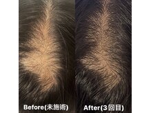 ヘッドサイエンス(HEADSCIENCE)の雰囲気（円形の方も多くご来店いただいております！お気軽にご相談下さい）