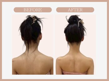 スリムライン 山形店(The Slim Line)/before→after