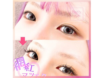 プリティアイ(pretty eye)の写真
