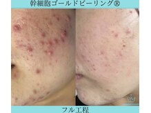 リメイククリニカルビューティー(Remake clinical beauty)/