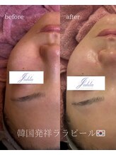 ユフラ(Juhla)/韓国3D毛穴＋ララピール