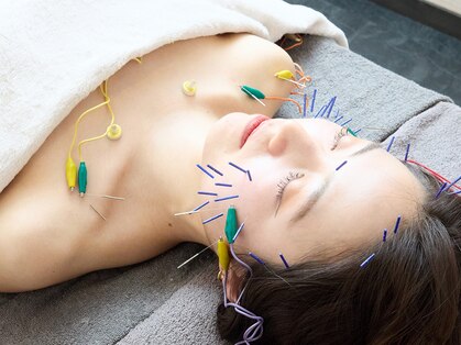 ソエルテの写真