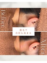 ビーエックス(.BX)/全身脱毛・うなじ脱毛・ワックス