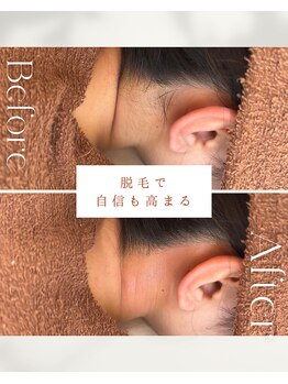 ビーエックス(.BX)/全身脱毛・うなじ脱毛・ワックス