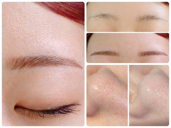 トータルビューティ ノイド(Noid)/いちご鼻撃退+美眉毛WAX脱毛