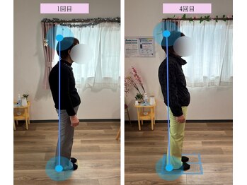 カラダリリース 浜松店/姿勢改善事例