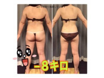 ボディエステティック アクアオーラ 富山店/後ろ姿も美人さんに