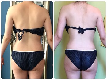 クランシュプール 恵比寿店/【上半身ダイエット/引き締め】