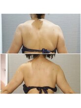 エイジングケア専門サロン サンク(thanq)/凝り太り・疲労太り・歪み太り