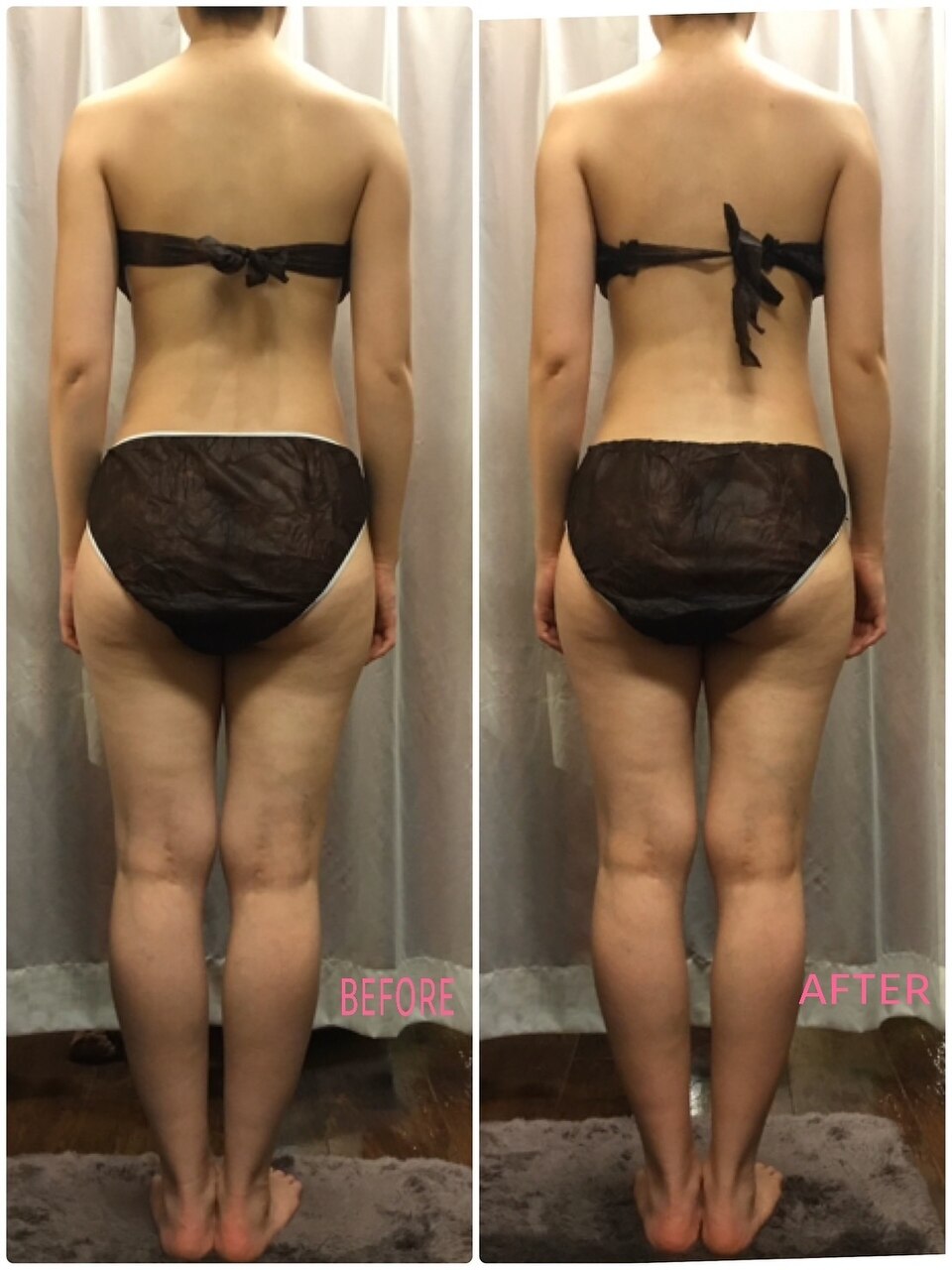 フォト|ドクタージェーナ(Dr.Jena)|ホットペッパービューティー フォト|ドクタージェーナ(Dr.Jena)|ホットペッパービューティー