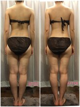 ドクタージェーナ(Dr.Jena)/筋膜リリース