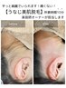 大人気！お気軽に10分で◎後ろ姿が垢抜けて綺麗が続く【うなじ美肌脱毛】3600