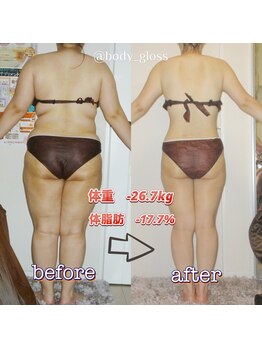 ボディグロス 梅田店(BODY GLOSS)/VIPセレブ2年ー26.7kg