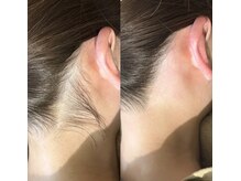 十美/【後ろ美人♪】before　after