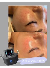 エネイブル(ENable)/