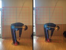 がじゅまる整体院 土浦店/姿勢ビフォーアフター