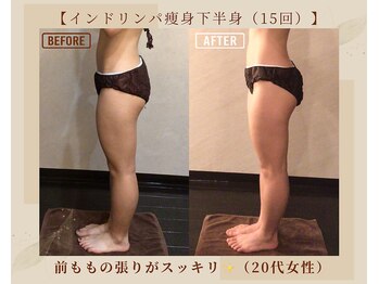 オキシー グレイス 黒崎店(OXY Grace)/インドリンパ下半身コース