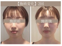 ドクターボディ 恵比寿店(Dr.Body)/【顔歪み/左右差/たるみ 20代】