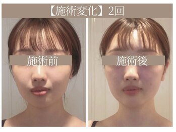 ドクターボディ 恵比寿店(Dr.Body)/【顔歪み/左右差/たるみ 20代】