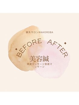マホロバ(mahoroba)/結果出る美容鍼ビフォーアフター