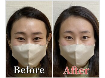 整体ラルース 中目黒(LALUZ)/20代 女性 小顔ヘッドスパ 二重