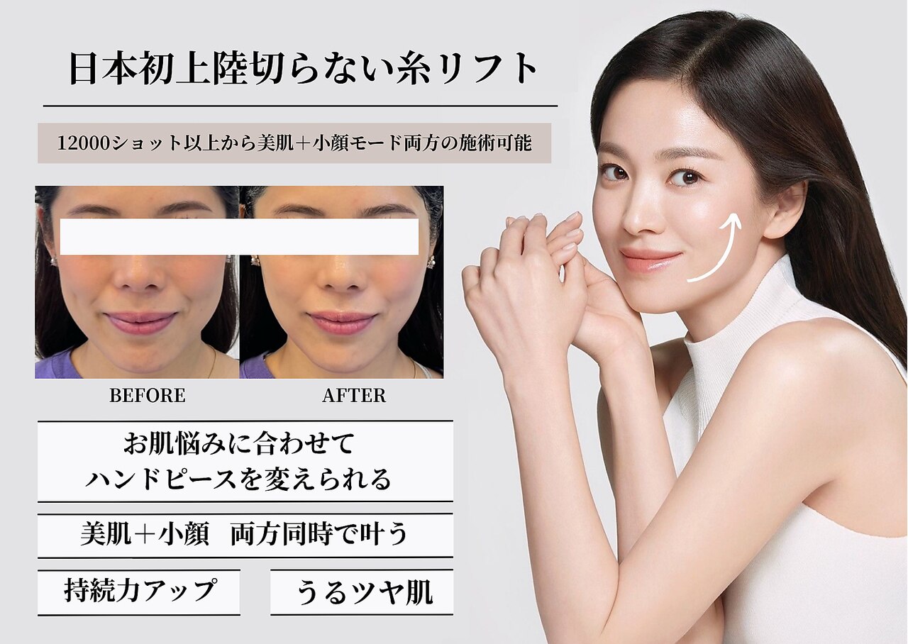 エレクトロポレーション　エステ ポレーション美顔器 HDの通販｜セブンビューティー