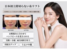 エヌズ(Ns)