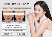 エヌズ(Ns)