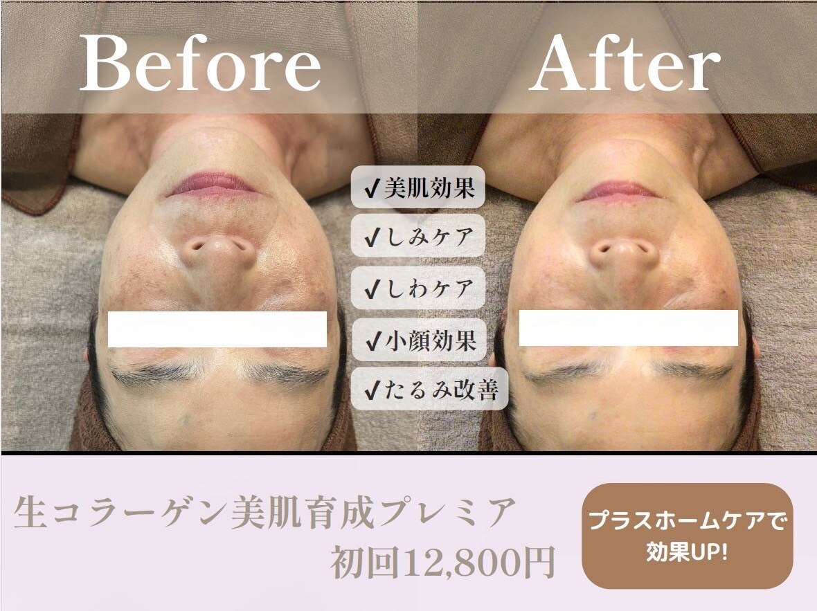 表情筋トレーニング 東京に関するエステサロン 脱毛＆フェイスリフト