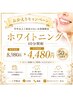 【おかえりキャンペーン】半年以上ご来店のないお客様限定ホワイトニング！！