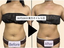 アオレニア(ao.lenia)の雰囲気（漢方オイル痩身で代謝UPxサイズダウン！ぽっこりお腹解消★）