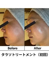 ルアナ 北谷店/タラソケア 《沖縄/北谷》