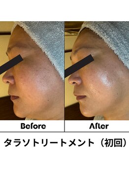 ルアナ 北谷店/タラソケア 《沖縄/北谷》