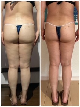 ラビーバ(Ravviva)/美脚になりたい方!