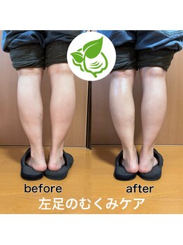 カイロプラクティック ネクサス/浮腫み撃退◇