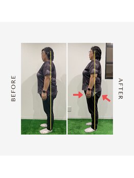 ウェルト(Wellto)/股関節まわりの痛みの軽減